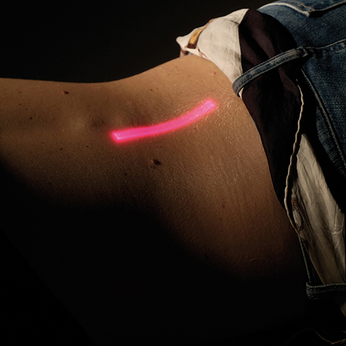 جهاز ليزر ماسح سكان 8 واط مع ترولي شاينسبورت EL12080