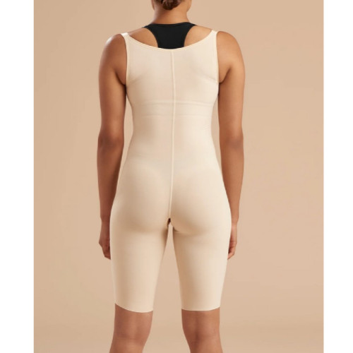 Mrena Abdominal Revision After Corset Back Closed SFBHS S