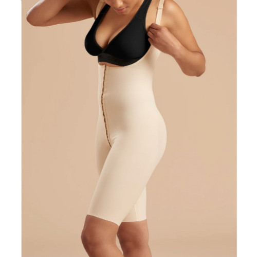 Mrena Abdominal Revision After Corset Back Closed SFBHS S