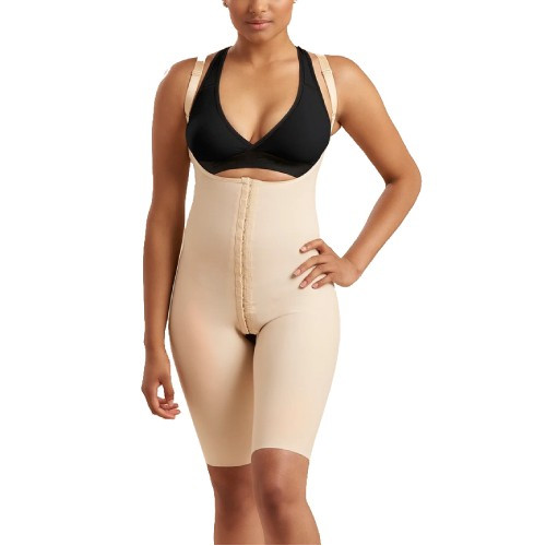 Mrena Abdominal Revision After Corset Back Closed SFBHS S