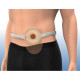 Convatec Belt for Colostomy