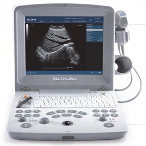 Edan Digital Diagnostic Ultrasound System DUS 60