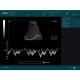 Edan Digital Diagnostic Ultrasound System DUS 60