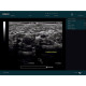 Edan Digital Diagnostic Ultrasound System DUS 60