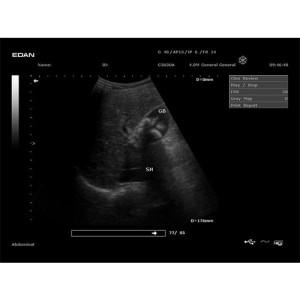 جهاز سونار ايدان التراساوند DUS 60