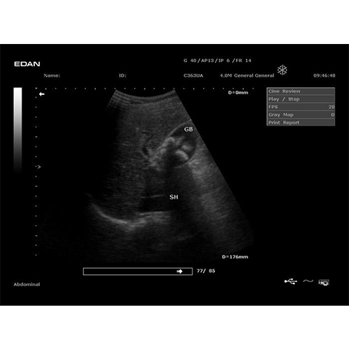 Edan Digital Diagnostic Ultrasound System DUS 60