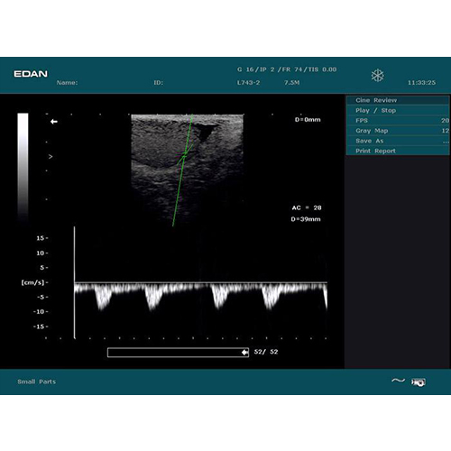 Edan Digital Diagnostic Ultrasound System DUS 60
