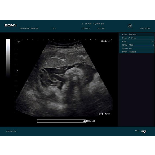 Edan Digital Diagnostic Ultrasound System DUS 60