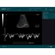 Edan Digital Diagnostic Ultrasound System DUS 60
