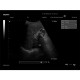 Edan Digital Diagnostic Ultrasound System DUS 60
